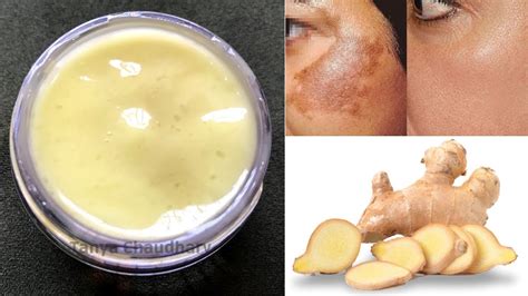 Vaadi herbals lemongrass for best cream for pigmentation, we will offer many different products at different prices for you to choose. DIY Ginger Cream | Remove Pigmentation, Dark Spots & Acne ...