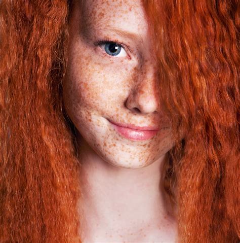 A Genetic Link Between Red Hair Freckles And Skin Cancer The