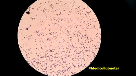 Streptococcus Agalactiae Introduction Morphology Pathogenicity