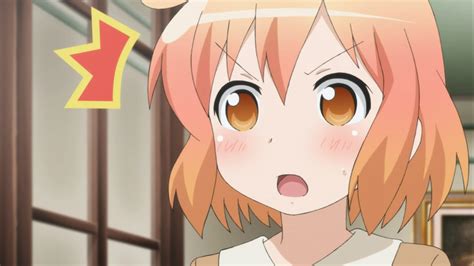 Annahof Laabat Surprised Anime Girl Face