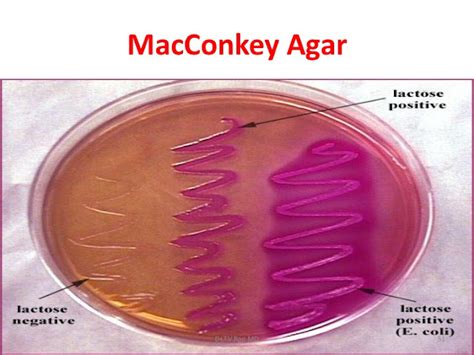 Macconkey Agar Principles Composition Preparation Uses And Colony
