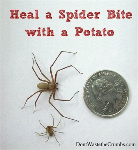 How To Heal A Spider Bite With A Potato Artofit
