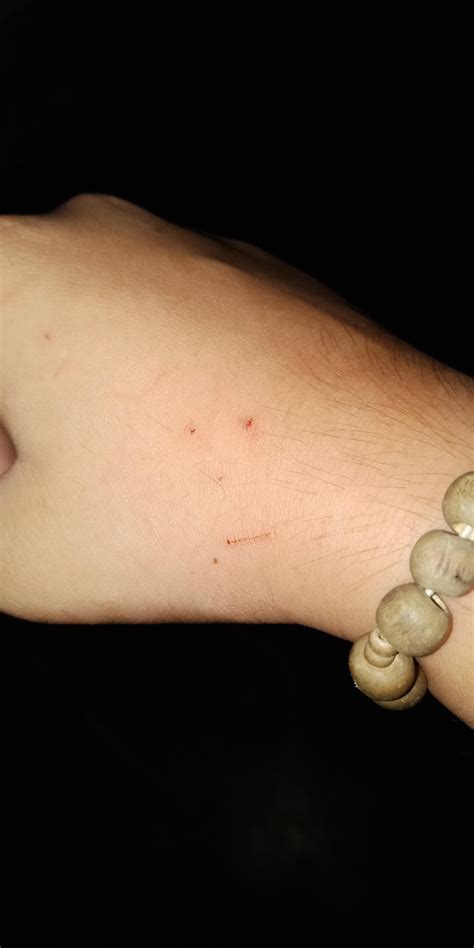 My Cat Scratched Me And It Made A Face Rmildlyinteresting