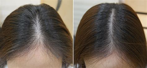 Don't be afraid to cut your long locks. Vitamin C for Hair Loss Thinning - NewBeauty