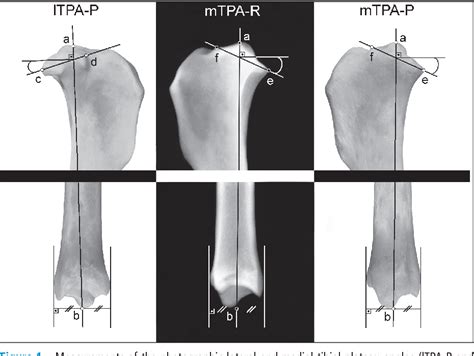 Lateral And Medial Tibial Plateau Angles In Normal Dogs An