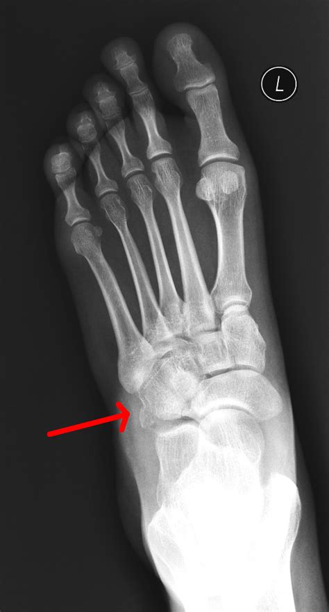 Foot Case 7 Answer Orthopedic Teaching Feinberg School Of Medicine
