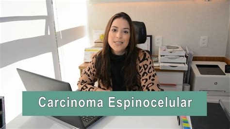 PÍlula DermatoscÓpica 5 Carcinoma Espinocelular Youtube