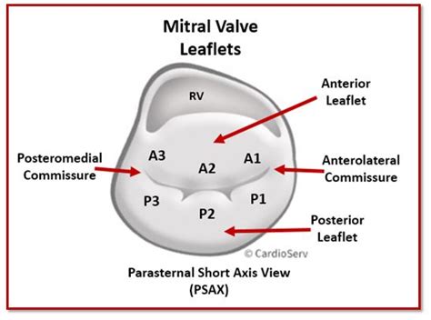Mitral Valve Anatomy Name 5 Components