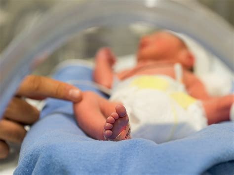 Low Dose Steroids In Preemies No Adverse Effects On Brain