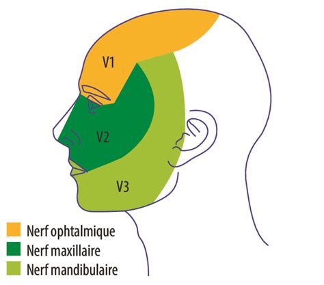 Névralgie Du Trijumeau Une Mise Au Point Figure 1