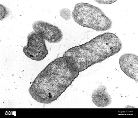 Transmission Electron Micrograph Of The Bacteria Salmonella Typhimurium