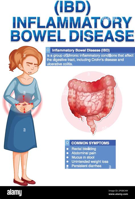 Inflammatory Bowel Disease Ibd Infographic Illustration Stock Vector Image And Art Alamy