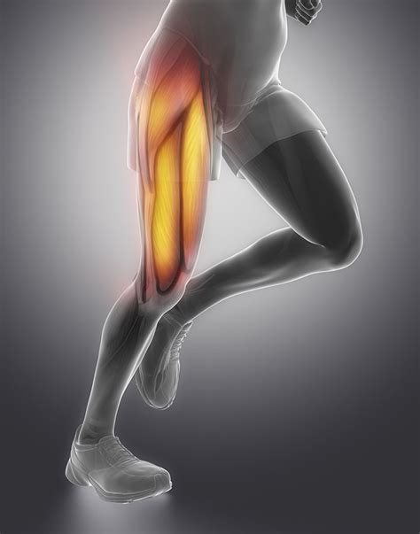 Quadriceps Tendinitis Quadriceps Tendon Pain In The Front Of Your Knee
