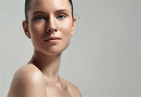 The Real Deal On Fake Freckles National Laser Institute Medical Spa