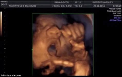 Video Shows Foetus Singing In The Womb By Moving Their Mouth And