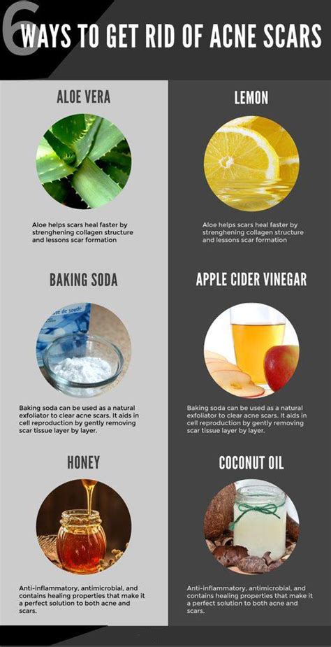 How To Get Rid Of Acne Scars Infographic Updated 2024