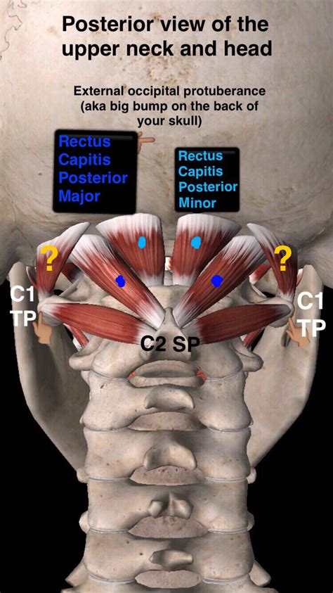 Suboccipital Muscles — James Mcafee Pt Dpt