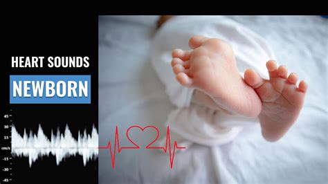 Newborn Heart Beat Sound How To Calculate Nb Heart Rate Normal Nb