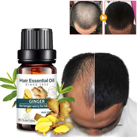 What Essential Oil Is Good For Hair Growth Hair Growth Essence Fast