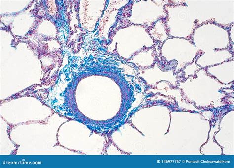 Human Lung Tissue Under Microscope View Stock Image Image Of Gullet