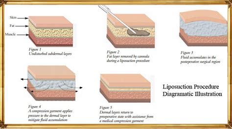 How To Check Your Body Fat Levels Akruti