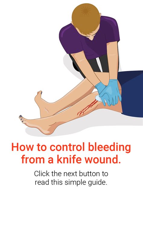 Knifesavers How To Control Bleeding