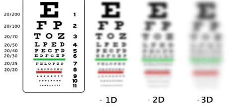 Can Myopia Nearsightedness Be Improved Naturally Happy Eyesight