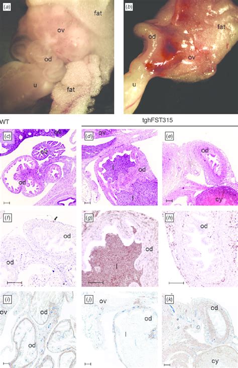 The Oviducts Of Adult Tghfst315 Mice Are Malformed Gross Appearance Of