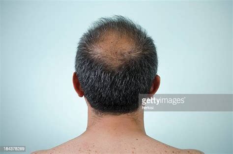 Bald Head Photos And Premium High Res Pictures Getty Images