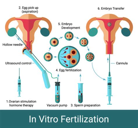 Stages Of In Vitro Fertilization Ivf