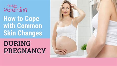 Common Skin Changes During Pregnancy How To Deal With Them Youtube