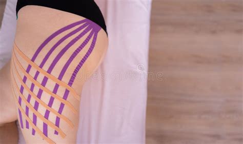Applying Kinesiology Tape To Female Patient Legskinesiology Taping Anti Cellulite Procedure