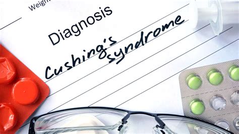 Sindromul Cushing Cauze Simptome Si Complicatii