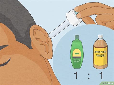 How To Treat A Fungal Ear Infection 3 Best Methods