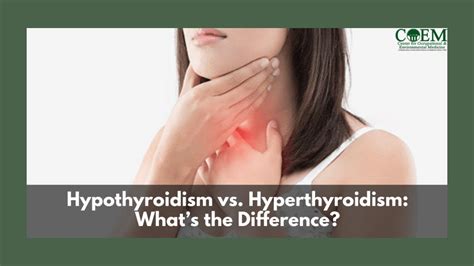 hypothyroidism vs hyperthyroidism what s the difference youtube