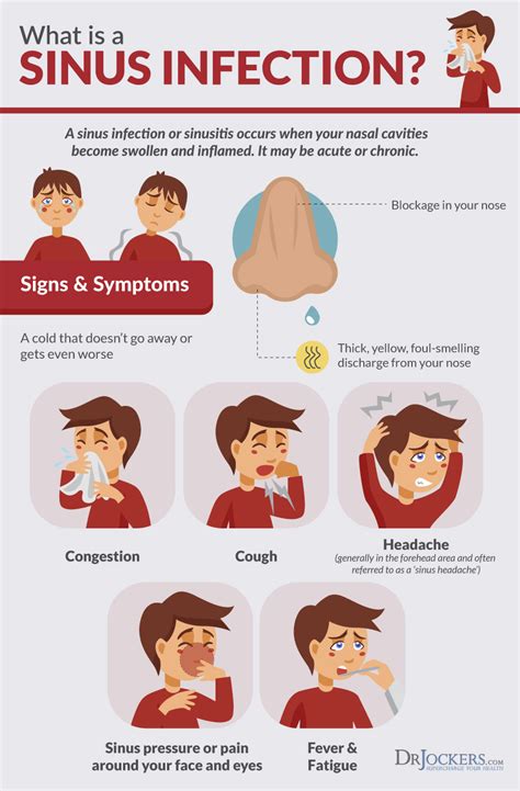 Sinus Infections Causes Symptoms And Natural Support Strategies