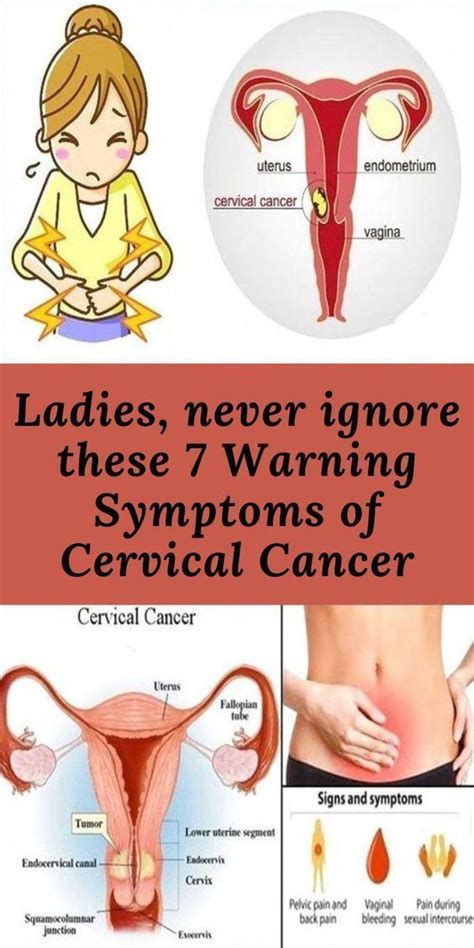 Warning Symptoms Of Cervical Artofit