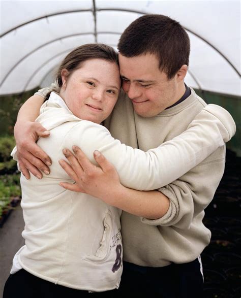 Adult Couple With Downs Syndrome Wellcome Collection