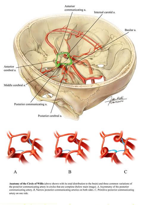 This arterial circle was well known before thomas willis, but it is said that. Anatomy of the Circle of Willis - Art as Applied to Medicine