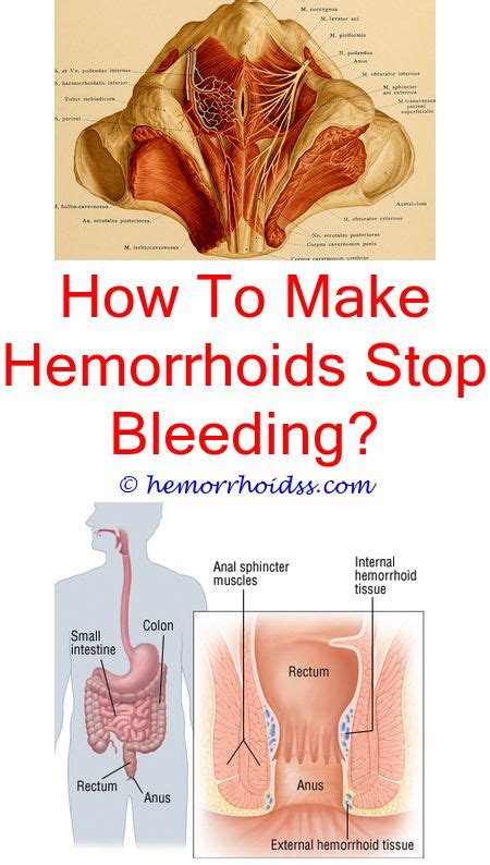 What Do Hemorrhoids Look Like On The Outside Cure For Hemorrhoids