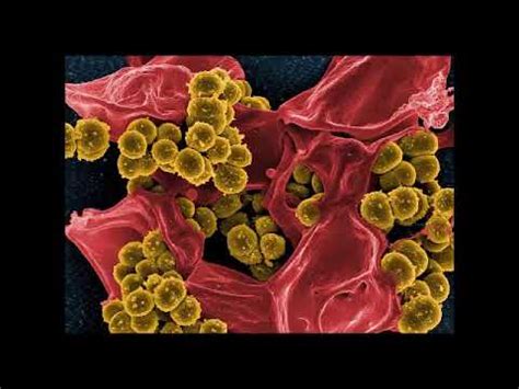 Maybe you would like to learn more about one of these? MRSA Infektion - Risiken, Symptome, Vorbeugen - YouTube