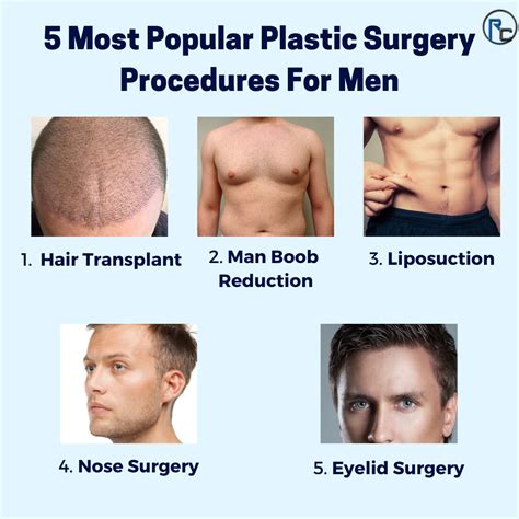 Albums 90 Pictures Plastic Surgery For Men Before And After Photos
