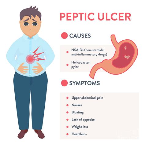 Peptic Ulcer Photograph By Art4stockscience Photo Library Pixels