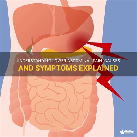 Understanding Lower Abdominal Pain Causes And Symptoms Explained Medshun