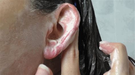 Ear Washing Ear Cleaning Ada S Pleasurex Clips4sale