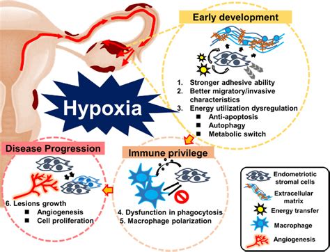 Schematic Drawing Shows The Pathophysiological Effects Of Hypoxia