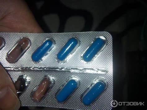 Редуксин 15 мг не похудела Отзыв о Таблетки для похудения Promo-Med Редуксин | Не хочется кушать Отзыв о Таблетки для похудения Promo-Med Редуксин | Не хочется кушать Редуксин 15 мг не похудела