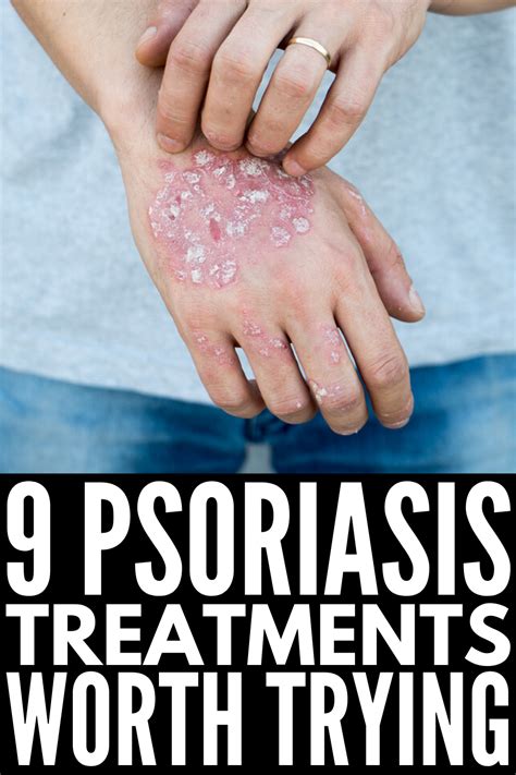 How To Get Rid Of Psoriasis 9 Tips And Remedies To Try