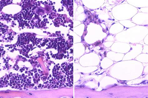 Genetic Factors Control Regenerative Properties Of Blood Forming Stem