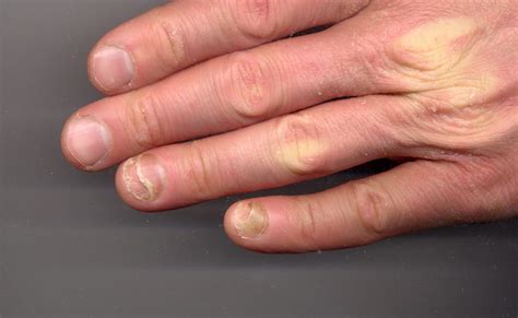 ≡ 7 Fingernail Problems That Are Actually Serious Health Warnings